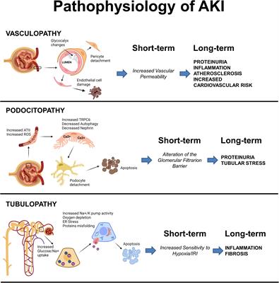 Recent advances in molecular mechanisms of acute kidney injury in patients with diabetes mellitus